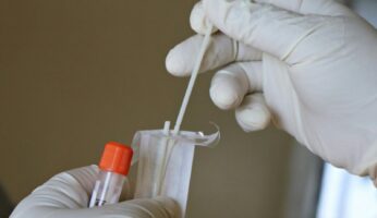 white cotton buds on persons hand, How Long Does THC Stay in Your Pee?